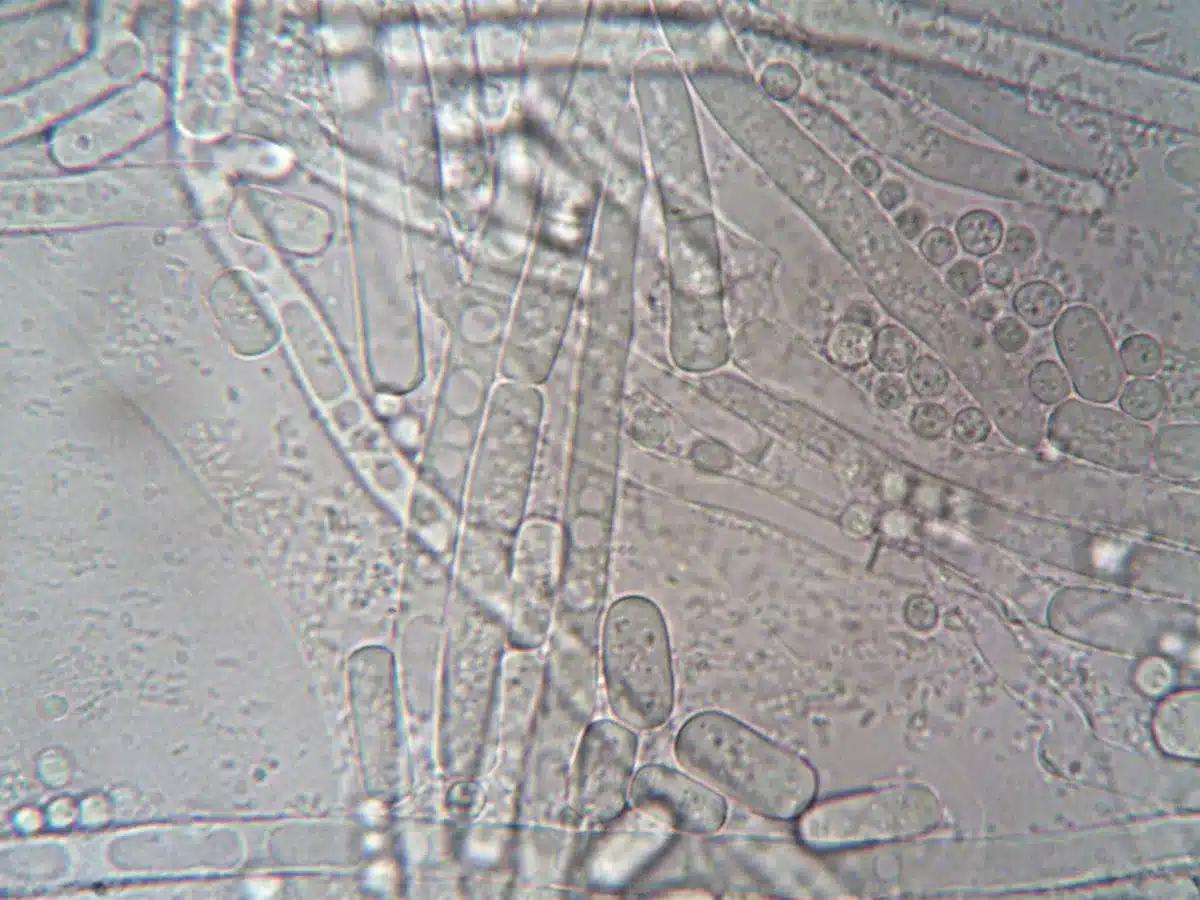 Microrganismi e batteri osservati al microscopio in laboratorio